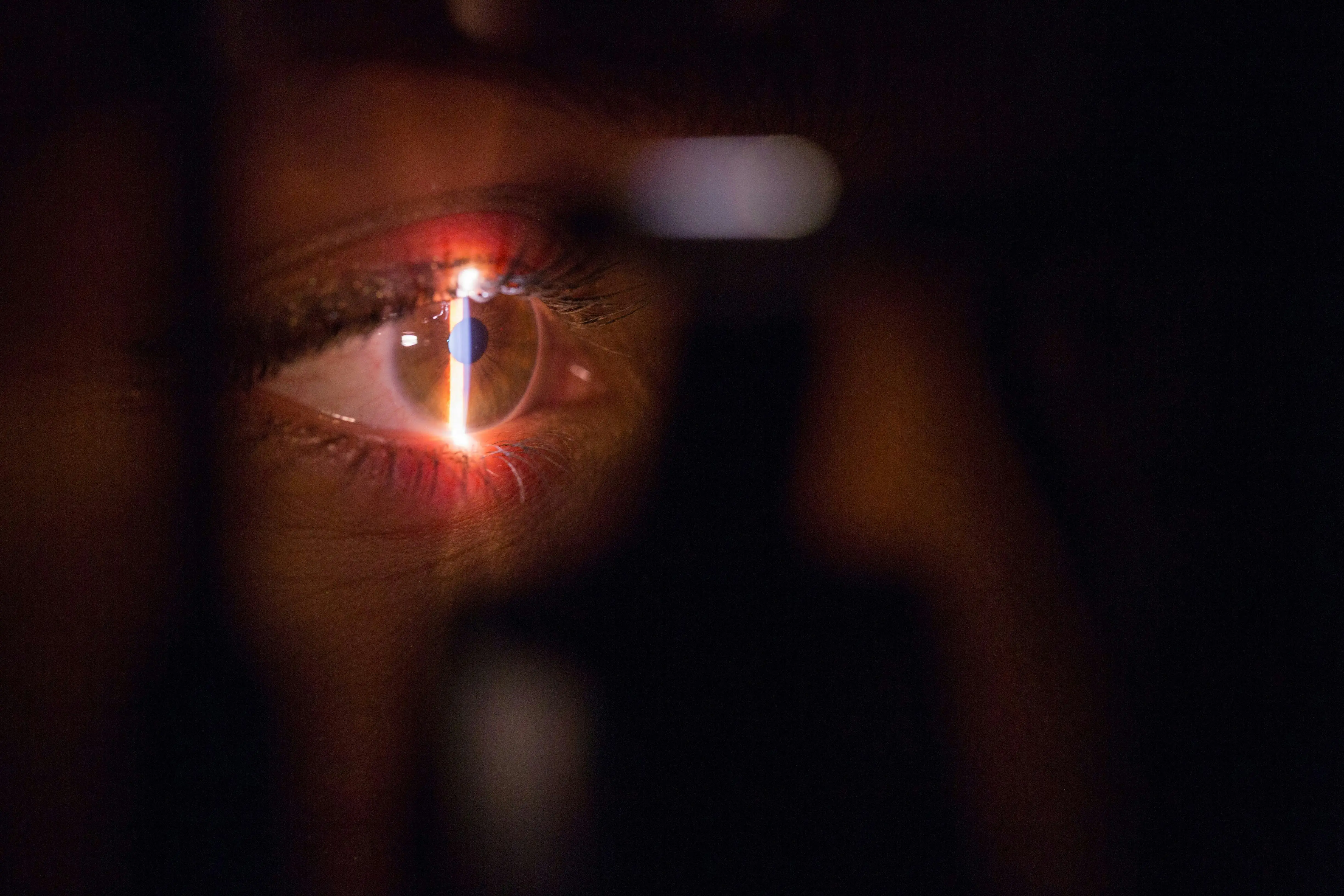 imagen de un ojo humano